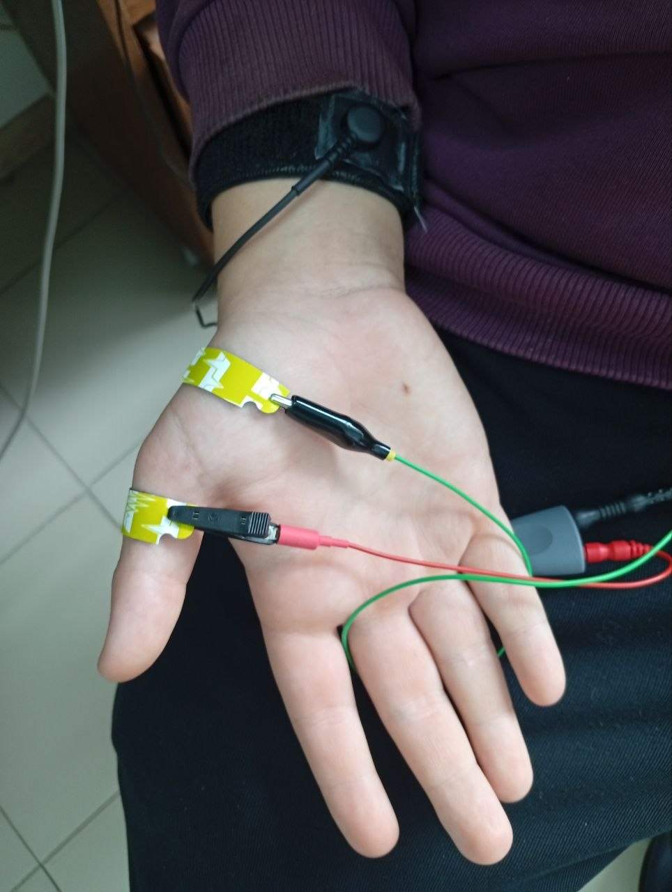 Диагностика нервов